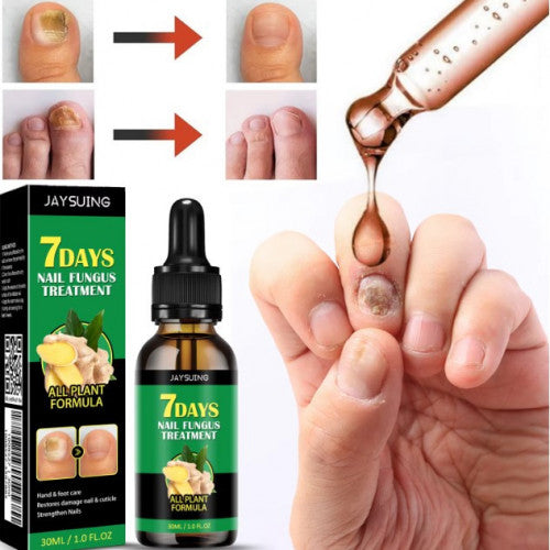 7 DAYS Tratamiento para Hongos Uñas – Pies y Manos (30 ml)